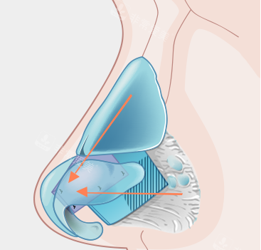 鼻子內(nèi)部結(jié)構(gòu)卡通圖