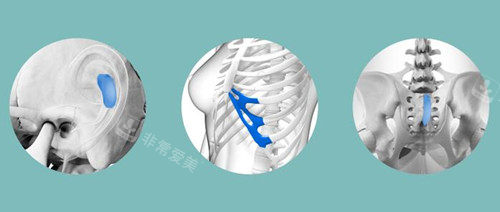隆鼻失敗修復(fù)所用自體軟骨材料 隆鼻失敗修復(fù)所用自體軟骨材料