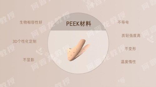 PEEK材料優(yōu)勢(shì) PEEK材料優(yōu)勢(shì)