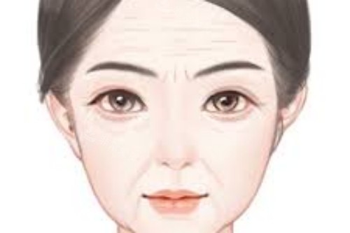 面部拉皮手術(shù)宣傳圖