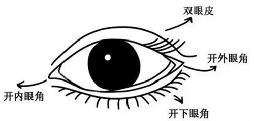 開眼角部位展示圖 開眼角部位展示圖