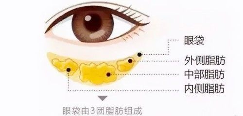 眼袋卡通图