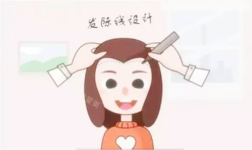 發(fā)際線植發(fā)設(shè)計卡通圖 發(fā)際線植發(fā)設(shè)計卡通圖