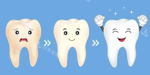 牙齿美白示意图 牙齿美白示意图