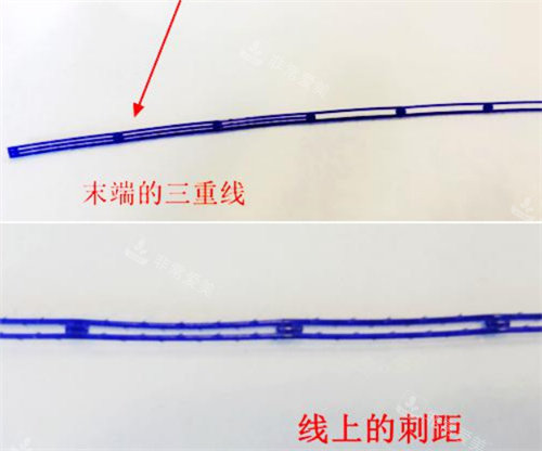 韩国普罗菲耳整形三重埋线图