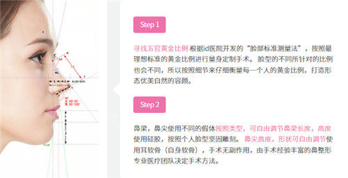 韓國id整形隆鼻手術(shù)特點(diǎn) 韓國id整形隆鼻手術(shù)特點(diǎn)