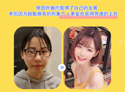 韓國id李知赫輪廓三件套真人實例