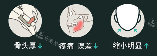 韓國原辰整形外科改善下巴