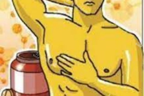 男性乳房發(fā)育癥手術宣傳圖