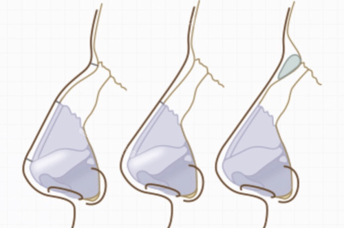 各种鼻子的形态表现