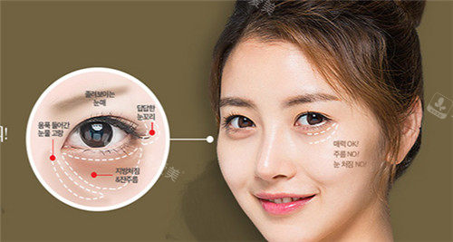韩国will整形眼修复多少钱？单纯双眼皮修复大概220万韩币！