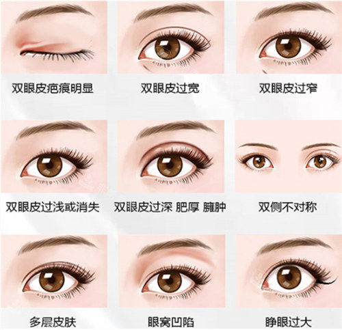 眼修復(fù)手術(shù)適應(yīng)癥 眼修復(fù)手術(shù)適應(yīng)癥