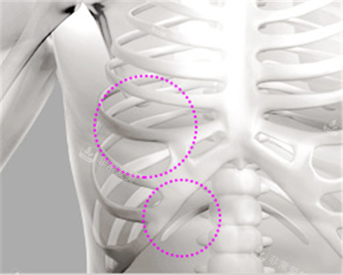 肋软骨提取位置展示