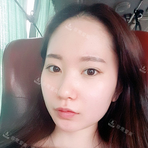 韓國現(xiàn)代美學(xué)整形輪廓三件套術(shù)前圖 韓國現(xiàn)代美學(xué)整形輪廓三件套術(shù)前圖