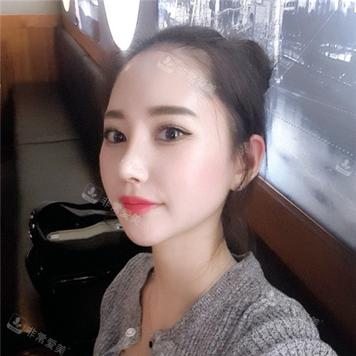 韓國現(xiàn)代美學(xué)整形輪廓三件套術(shù)后圖 韓國現(xiàn)代美學(xué)整形輪廓三件套術(shù)后圖