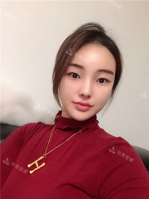 韓國現(xiàn)代美學(xué)整形輪廓修復(fù)術(shù)后圖 韓國現(xiàn)代美學(xué)整形輪廓修復(fù)術(shù)后圖