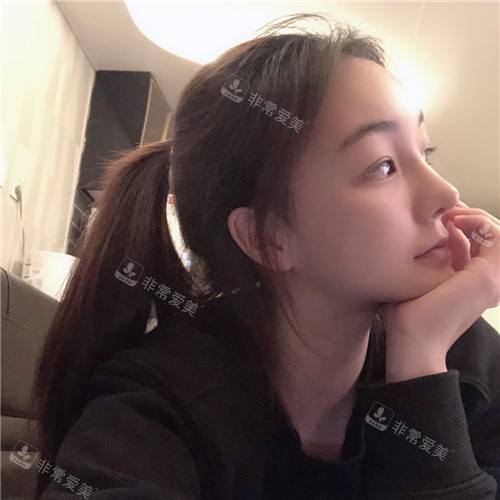 韓國現(xiàn)代美學(xué)整形輪廓修復(fù)術(shù)后照片 韓國現(xiàn)代美學(xué)整形輪廓修復(fù)術(shù)后照片