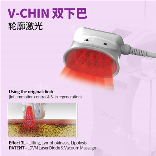V-Chin激光溶脂作用原理