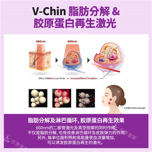 V-Chin激光溶脂作用介绍