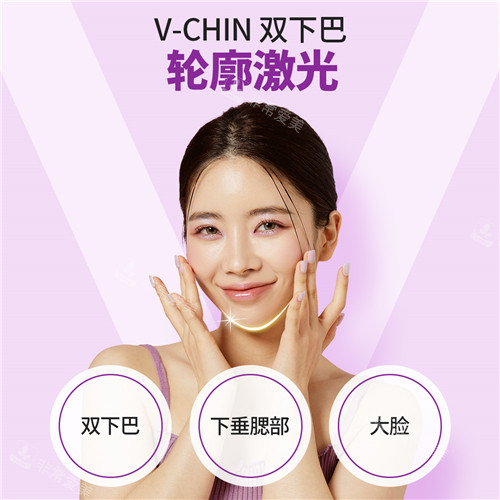 V-Chin激光溶脂宣传图示