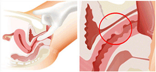 阴道动画图描述
