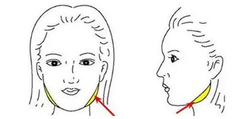 下颌角切除部位示意图