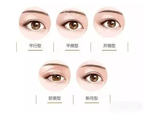 各種雙眼皮示意圖 各種雙眼皮示意圖