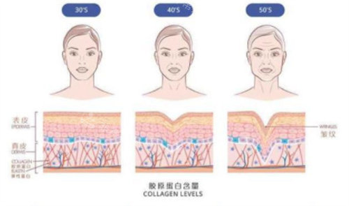 不同年龄段胶原蛋白流失情况图