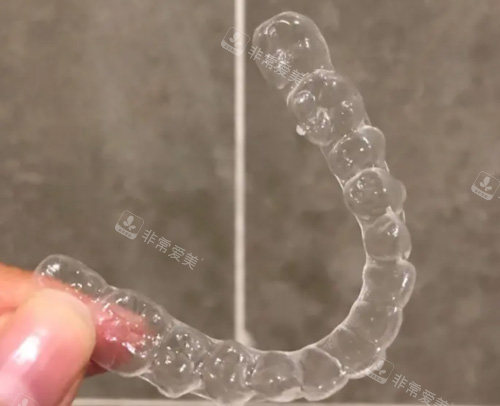 隐形牙套照片 隐形牙套照片