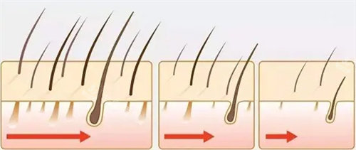 毛囊变化过程图