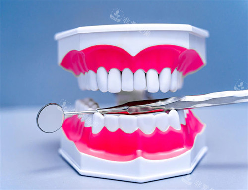 牙齿模型展示图