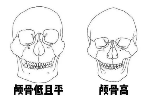 顱頂填充對(duì)比照 顱頂填充對(duì)比照