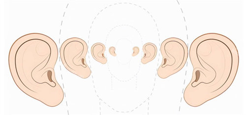 不同大小耳部形态参考图