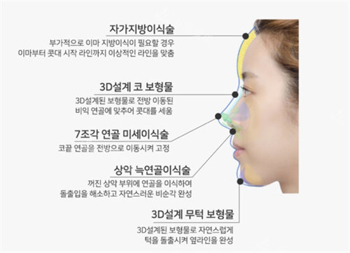 韩国温度整形轮廓定制鼻图