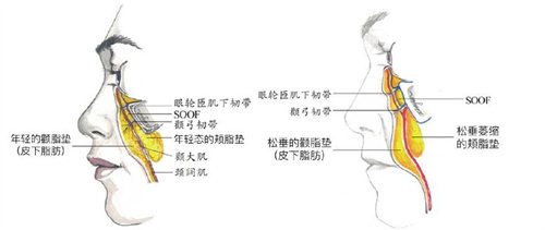 年轻皮肤和老化皮肤对比图