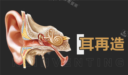 耳再造宣传图 耳再造宣传图