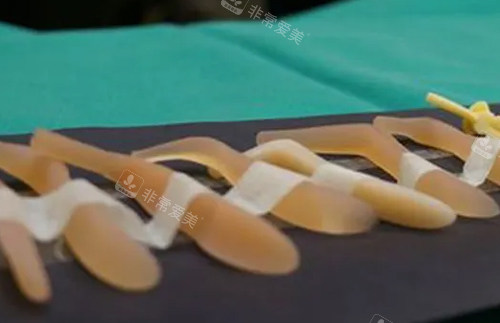隆鼻假體照片 隆鼻假體照片
