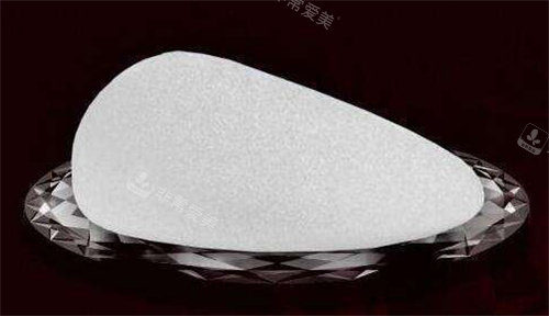 水滴形假体实例参考图 水滴形假体实例参考图