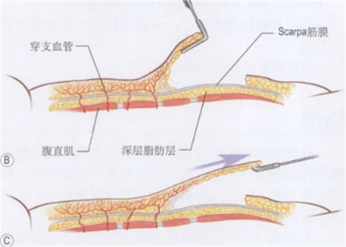 腹部深层脂肪层展示图