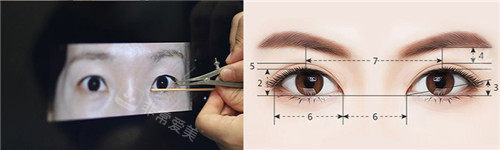 韩国will整形眼部手术设计图