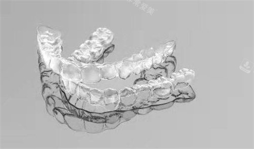 隐形牙套实例参考图