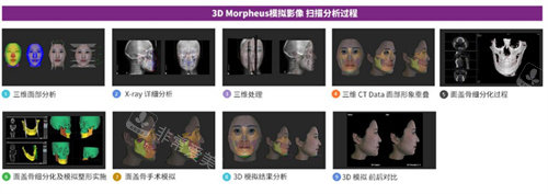 韩国必妩整形morpheus 3D技术展示图