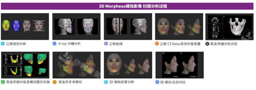 韓國必嫵整形morpheus 3D技術(shù)展示圖