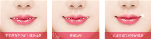 現(xiàn)代美學(xué)整形唇部整形宣傳圖 現(xiàn)代美學(xué)整形唇部整形宣傳圖