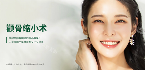 優(yōu)雅人整形外科醫(yī)院顴骨縮小對比