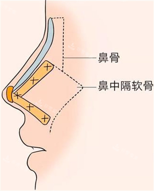 鼻子结构图