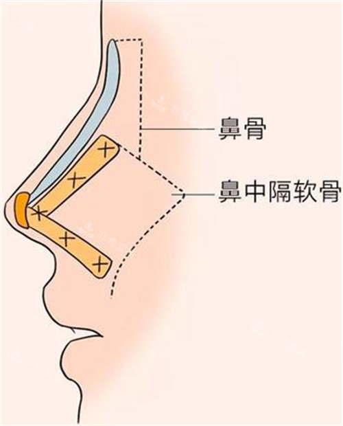 鼻子結(jié)構(gòu)圖