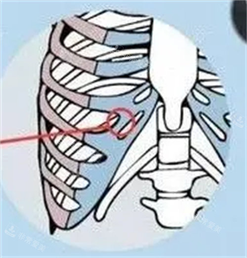 肋骨截取位置图