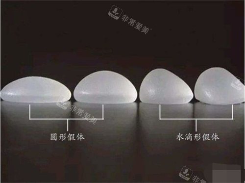 假體形狀示意圖 假體形狀示意圖