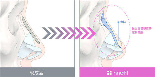 3d打印隆鼻假體表現(xiàn)圖